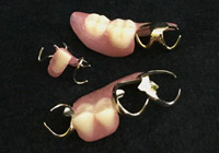 プラスチック保険義歯